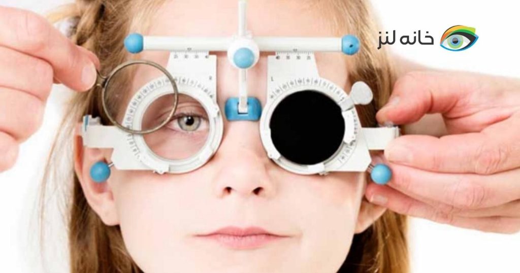 نحوه تبدیل نمره عینک به لنز طبی